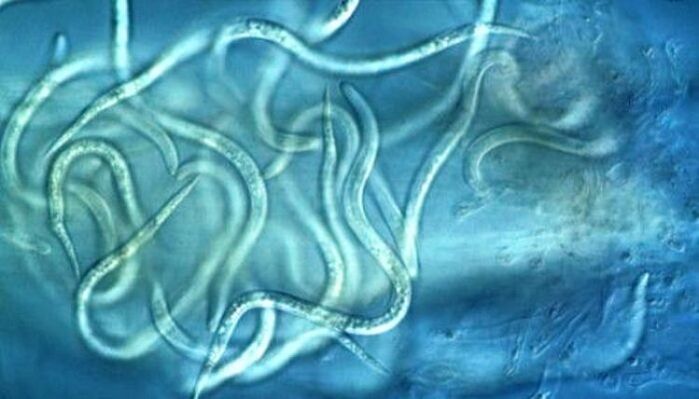 线虫寄生虫在人体内看起来像什么